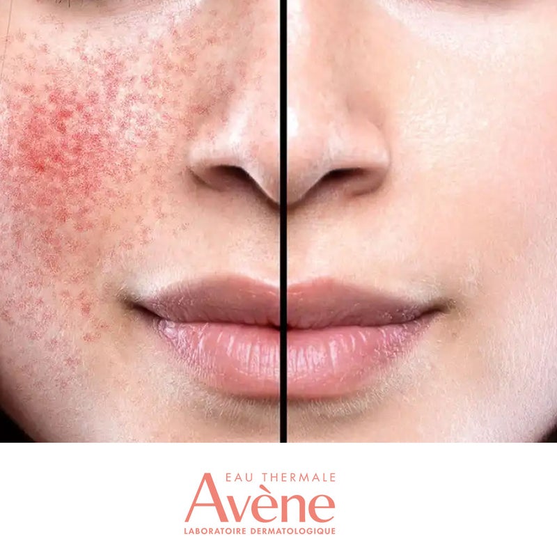 Avene Antirougeurs Jour Mositurizing Protecting Emulsion For Normal to Combination, Sensitive Skin 40ml