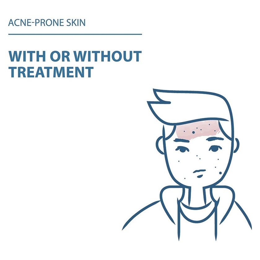 Ducray Keracnyl Foaming Gel 200ml