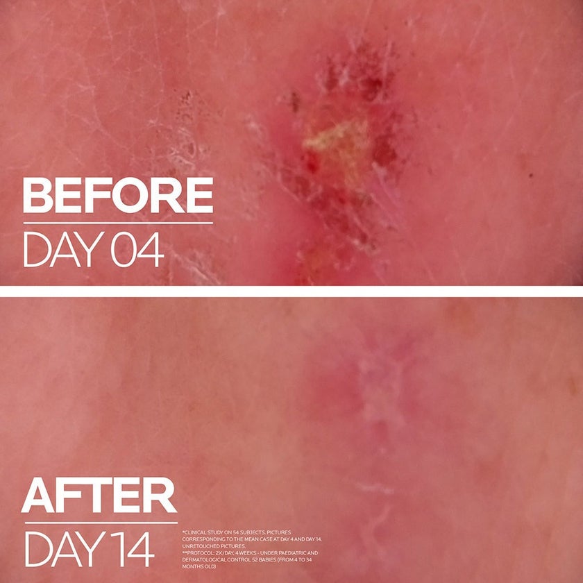 La Roche Posay Cicaplast Baume B5+ Ultra Repairing Balm 40ml