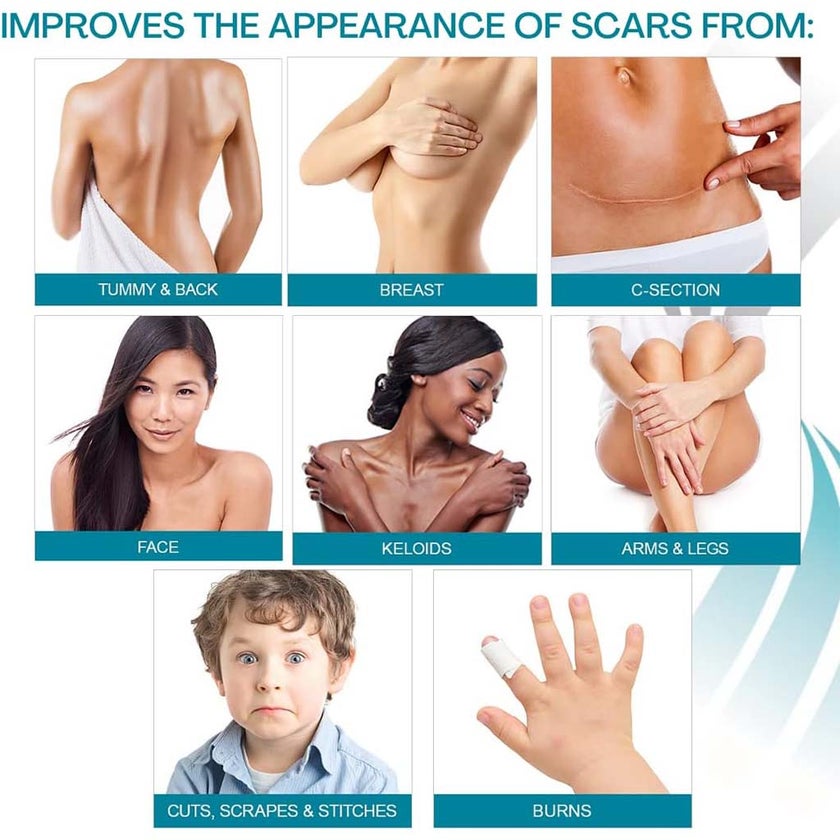 NewGel+E Advanced Medical-Grade Silicone Gel + Vitamin E for All Scar Types 15g