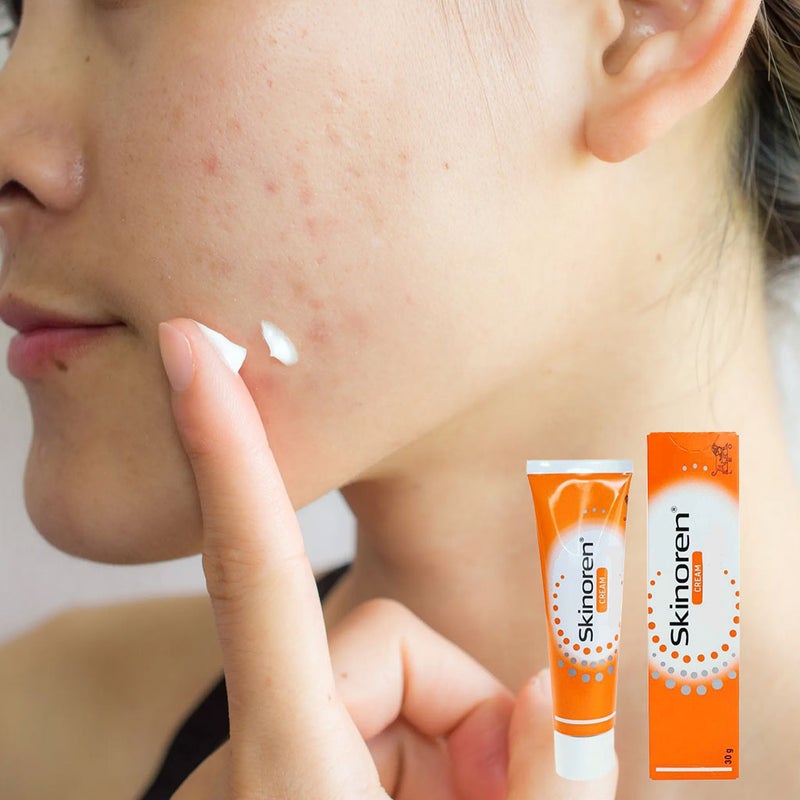 Skinoren Cream 30g