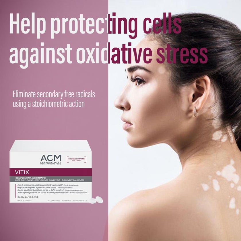 ACM Vitix Tablets, Antioxidant Dietary Supplement For Vitiligo, Pack of 30's