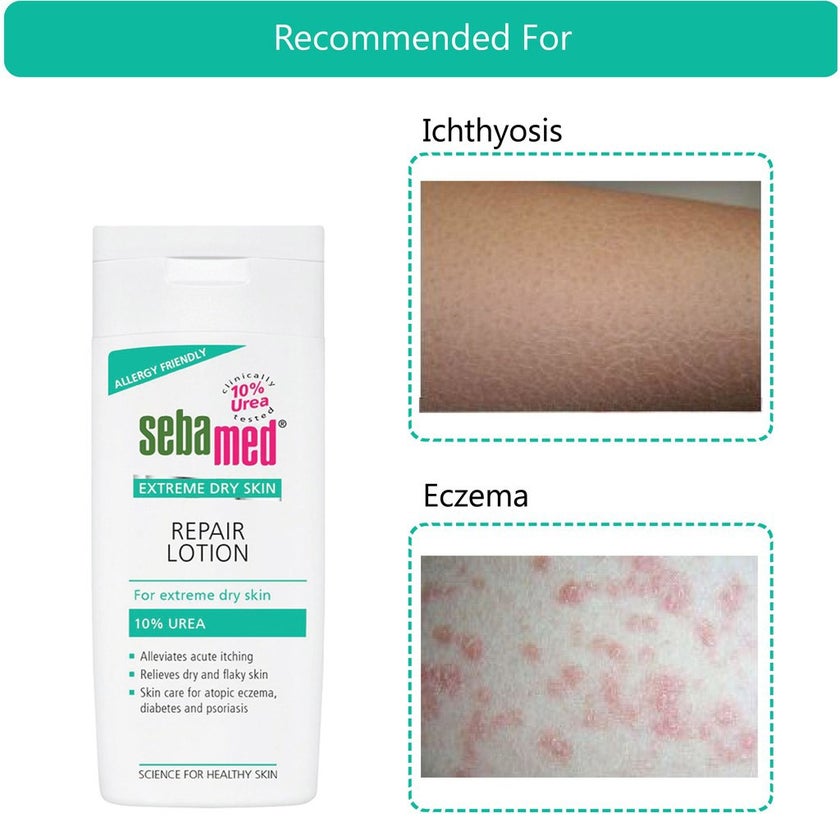 Sebamed Extreme Dry Skin Repair Urea Lotion 200ml