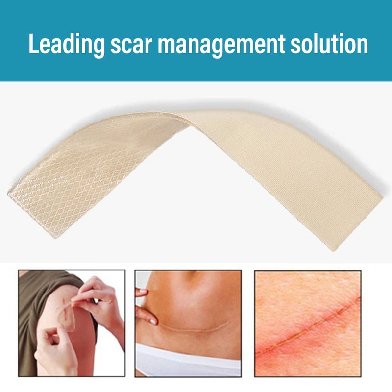 NewGel+ Advanced Medical-Grade 2" x 8" C-Section Strip For C-Section Scar Management, NG-160 Beige, Pack of 1's 