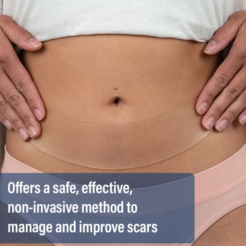 NewGel+ Advanced Medical-Grade 2" x 8" C-Section Strip For C-Section Scar Management, NG-360 Clear