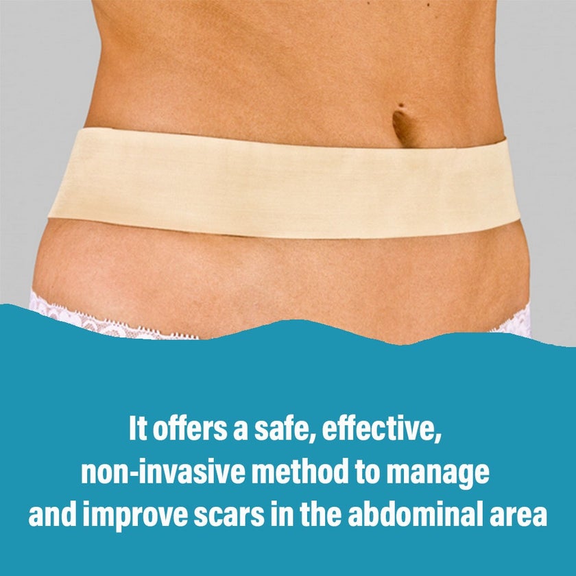 NewGel+ 24" x 2" Abdomen/Extremity Silicone Strip, Beige - NG-164