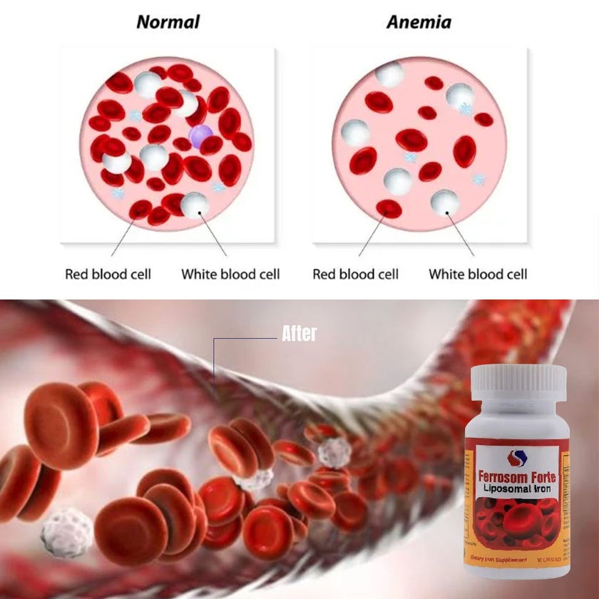 Ferrosom Forte Liposomal Iron Capsule, Pack of 30's
