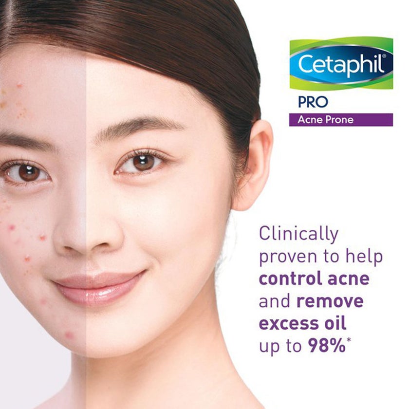 Cetaphil PRO Acne-Prone Skin Foam Wash 235ml