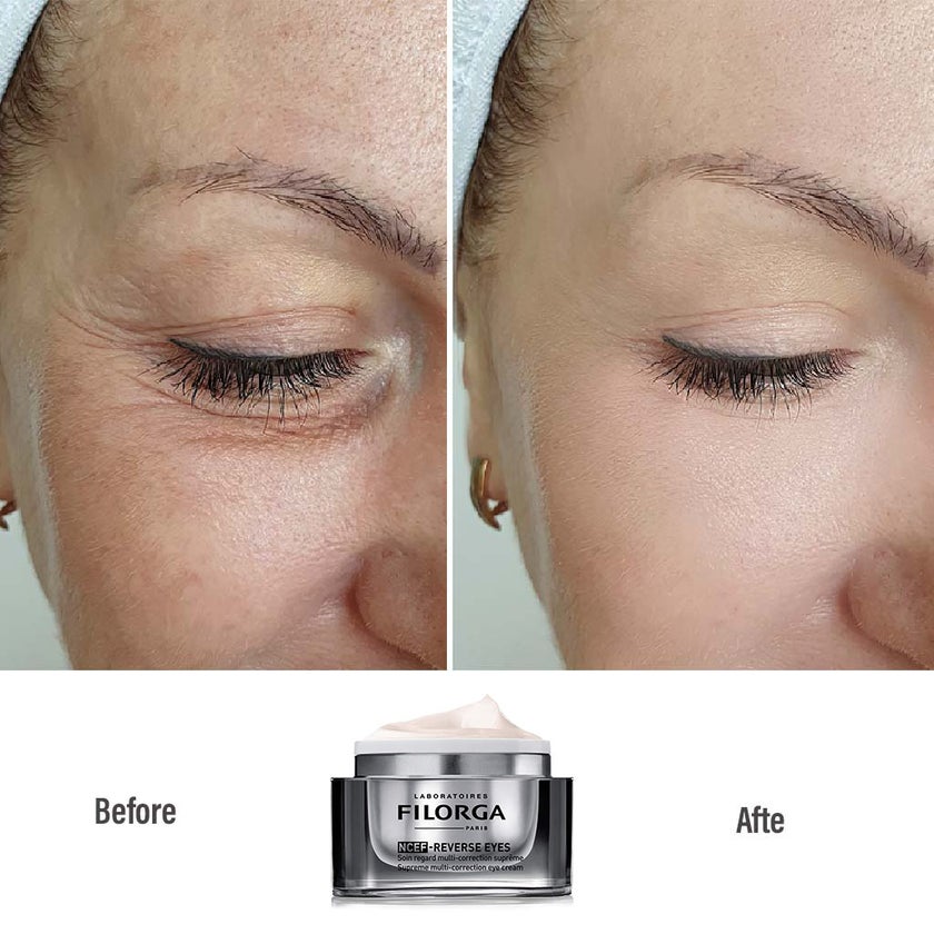Filorga NCEF Reverse Eyes Cream 15ml