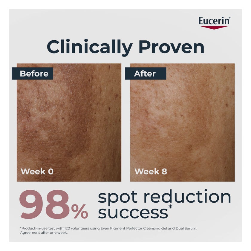 Eucerin Even Pigment Perfector Mono Chamber Dual Serum 30ml