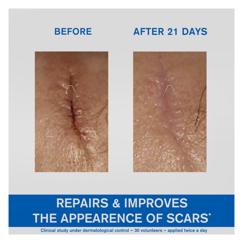 Uriage Bariederm-CICA Repairing Cream With Copper & Zinc 100ml