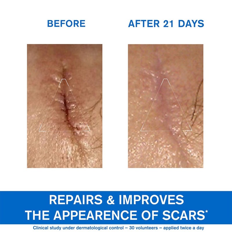 Uriage Bariederm-CICA Repairing Cream With Copper & Zinc 100ml