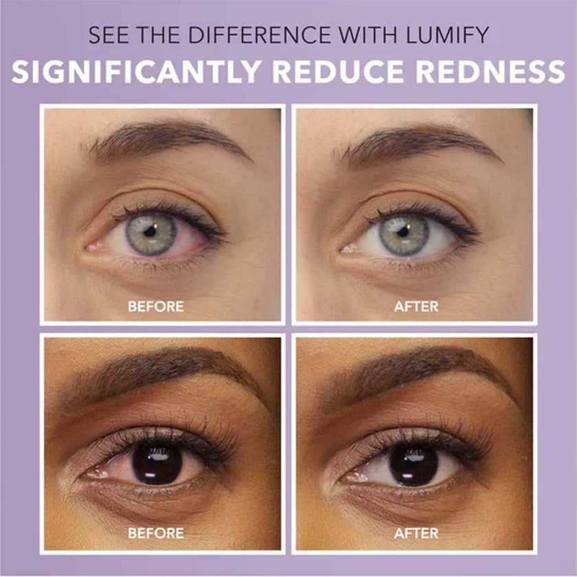 Lumify 0.025% Eye Drops 7.5ml