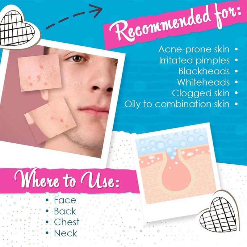 Bye Bye Blemish For Acne Drying Lotion 30 mL