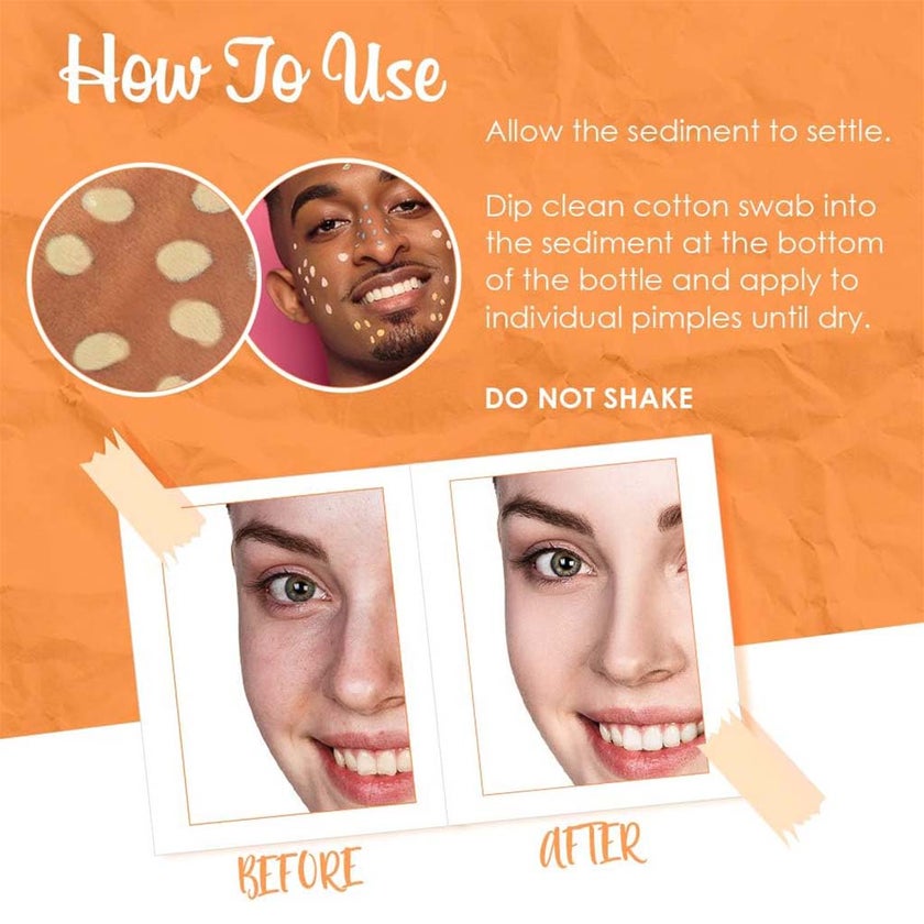 Bye Bye Blemish Vitamin C Dark Spot Brightening Lotion 30ml