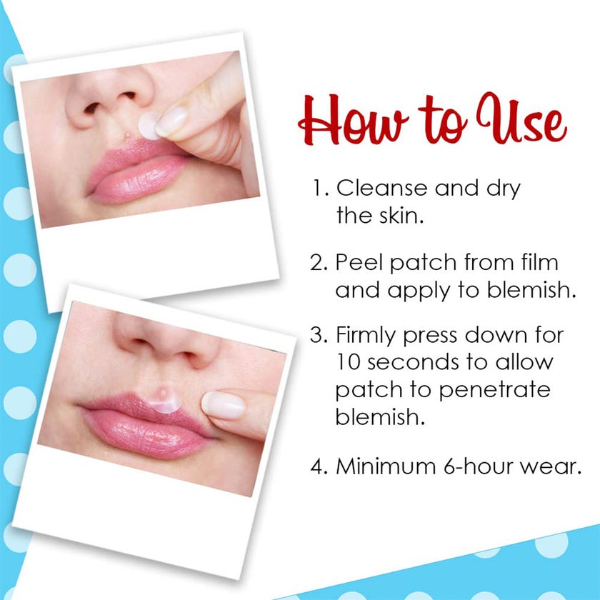 Bye Bye Blemish Microneedling Blemish Patches, Pack of 9's