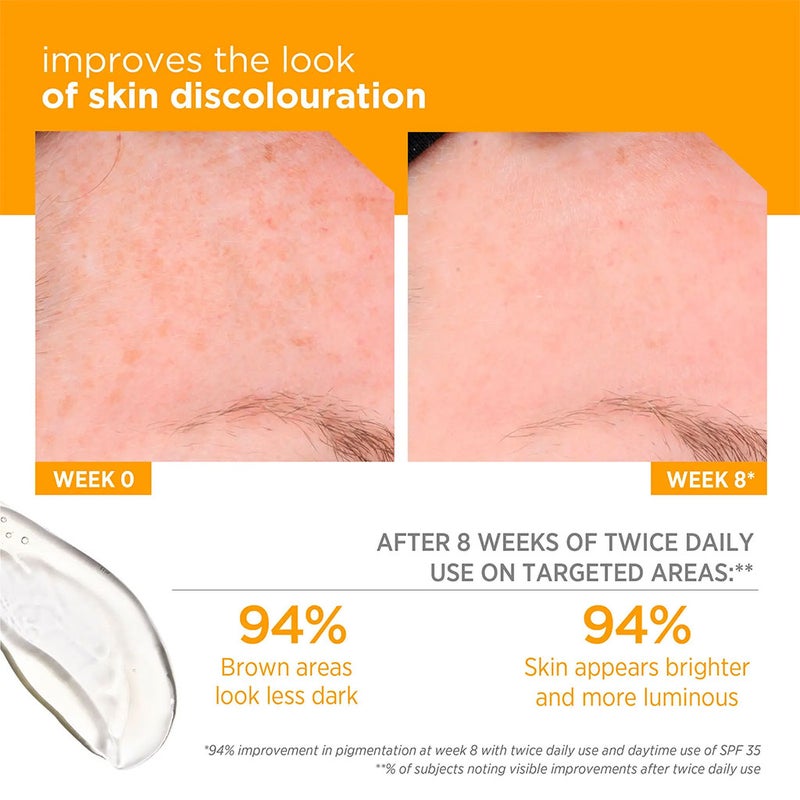 Neostrata Enlighten Pigment Lightening Gel For Dark spots and Uneven skin tone 40g