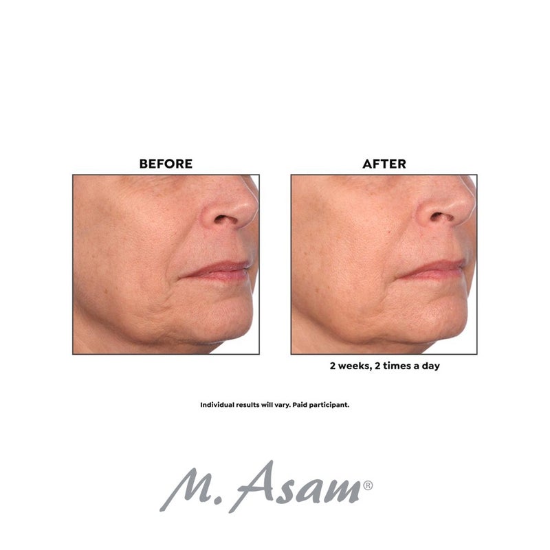 M. Asam Retinol Intense Retinol 1% Treatment Ampoule 1ml, Pack of 14's