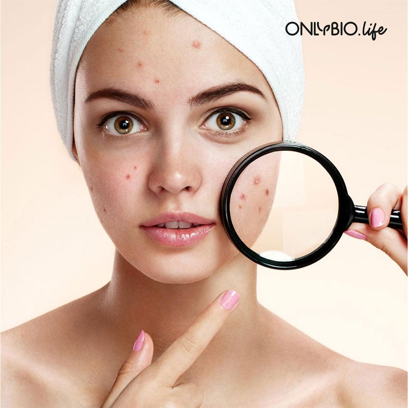 OnlyBio Botanic Clinic Acne Treatment Purifying Peeling Cream For Blemish Prone Skin 75ml