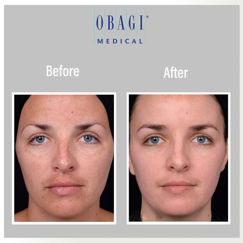 Obagi - C Fx C -Clarifying Skin Brightening Facial Serum With Vitamin C 30ml