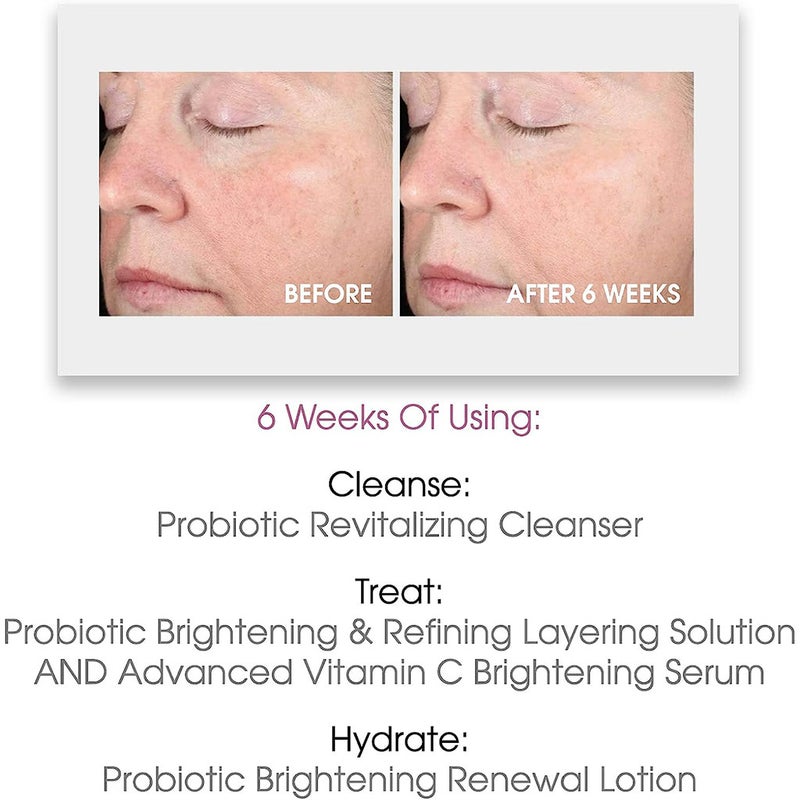GlowBiotics Probiotic Retinol Anti-Aging + Brightening Treatment For All Skin Types 30ml