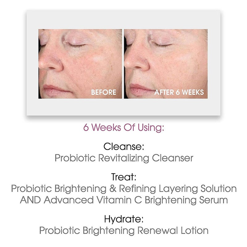 GlowBiotics Probiotic Brightening Renewal Lotion For All Skin Types 50ml