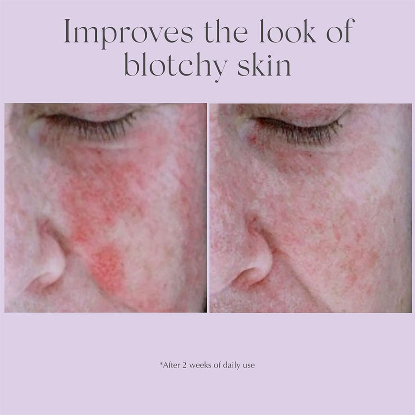 Exuviance AntiRedness Calming Face Serum 29g