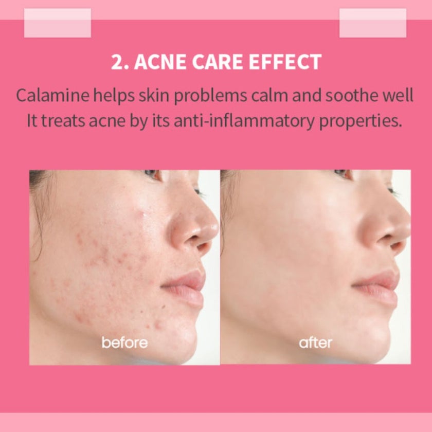 K-Secret Calamine 30 Days Secret Toner For Sensitive Skin 160ml