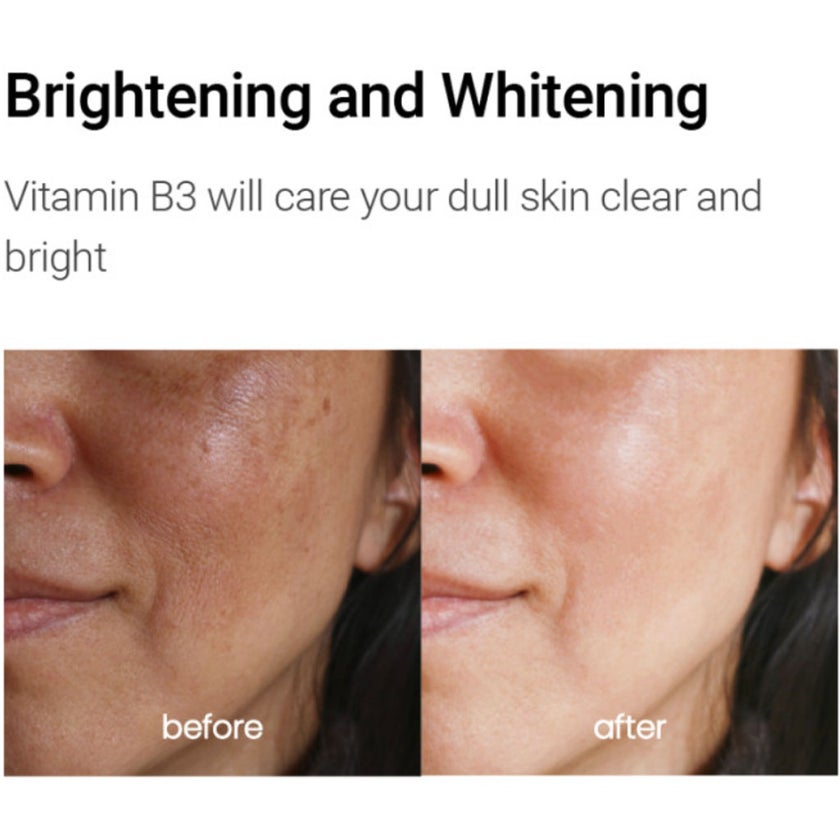 K-Secret Calamine Derma Secret Pink Solution Serum For Oily & Combination Skin Types 50ml