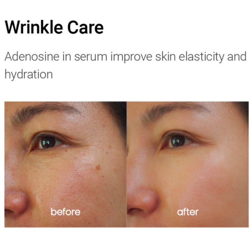 K-Secret Calamine Derma Secret Pink Solution Serum For Oily & Combination Skin Types 50ml