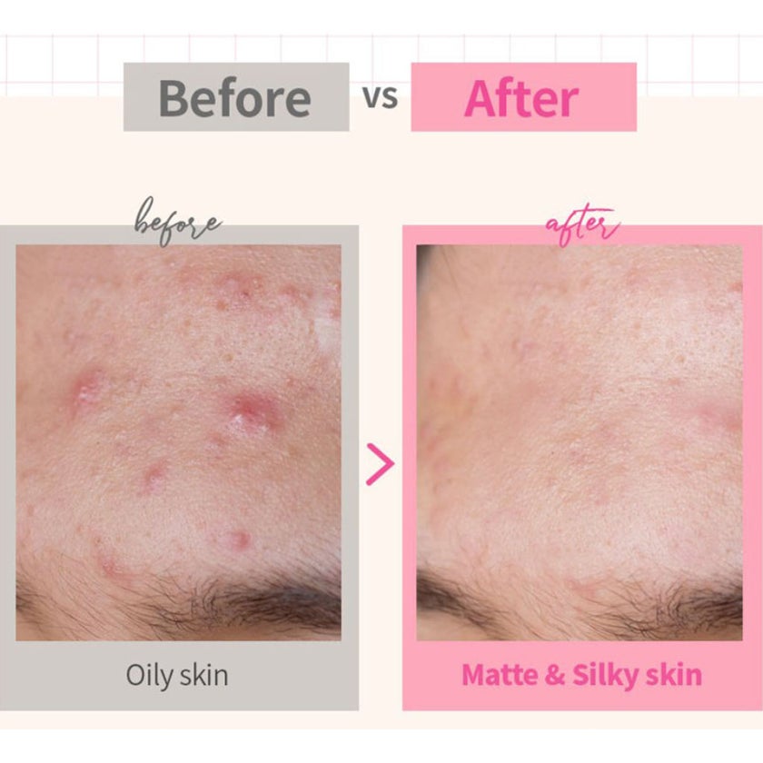 K-Secret Calamine Secret Bar For Sensitive Skin 100g