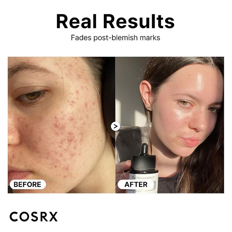 Cosrx The Niacinamide 15 Oil Control Acne Care Facial Serum 20ml