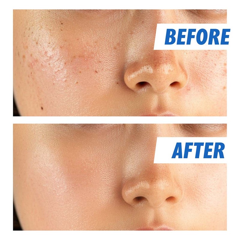 Nightingale Ecto Hyaluronic Moisturizing & Soothing Facial Toner For All Skin Types 200ml 