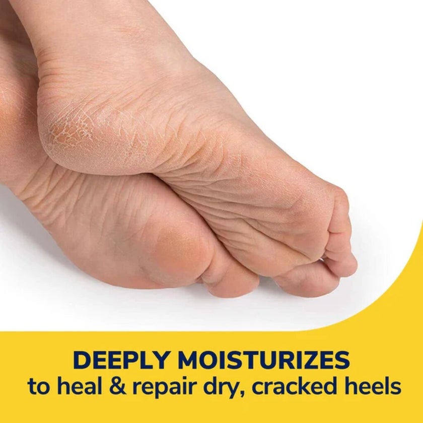 Dr. Scholl's Severe Cracked Heel Repair Restoring Balm 70g