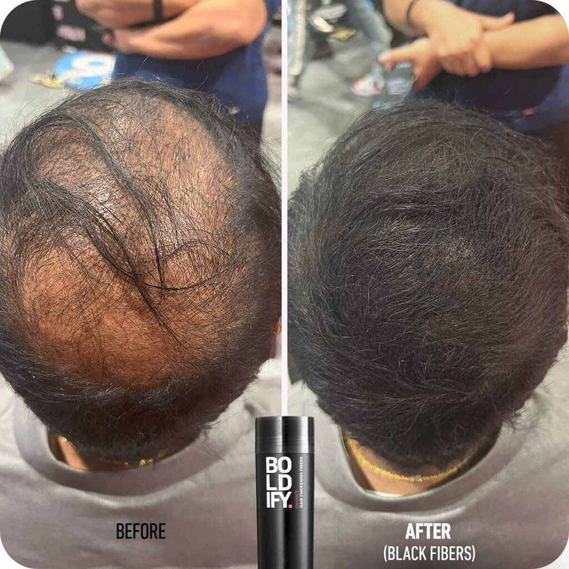 Boldify Enhance Hair Volumizing Thickening Fiber Powder For Thin Hair - Dark Brown, 28g