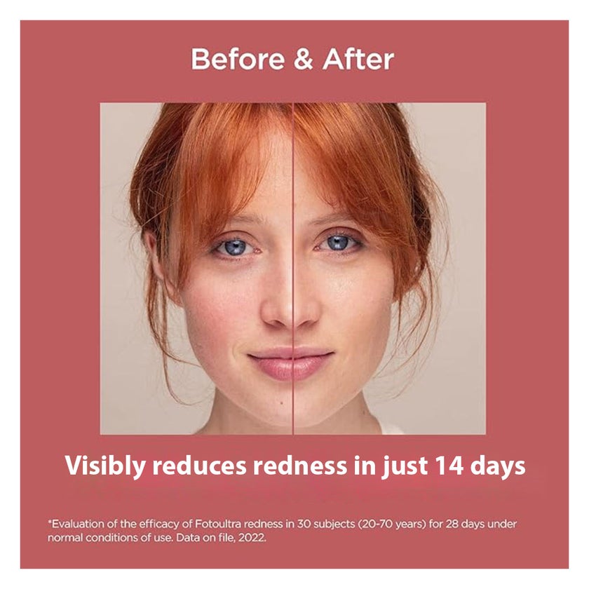 Isdin Fotoultra Redness SPF50 & PA++++ Sunscreen For Sensitive Skin 50ml