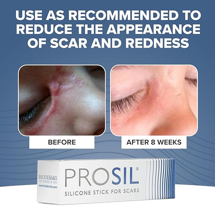 Biodermis Prosil Silicone Stick For Scars 4.25g