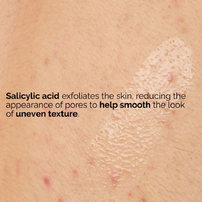 The Ordinary Salicylic Acid 0.5% Skin Exfoliating Body Serum For Acne 240ml