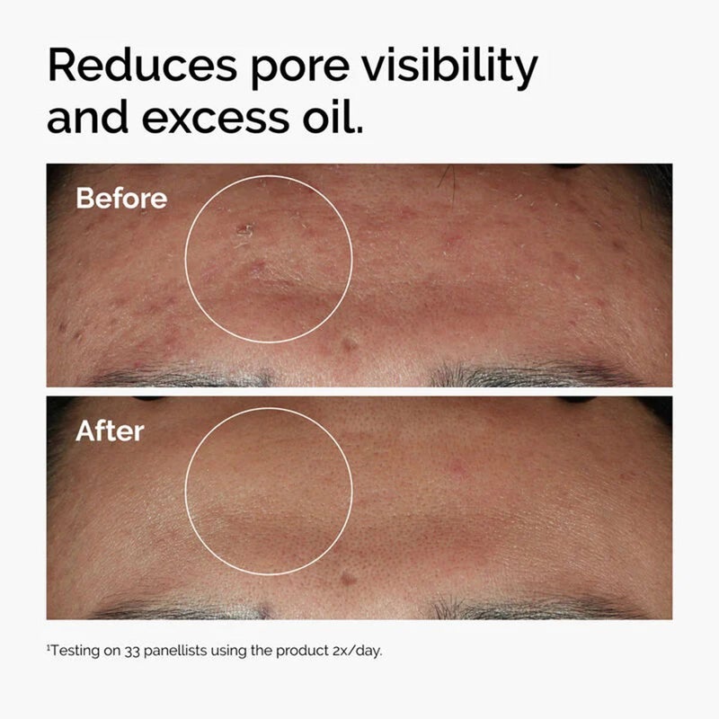 The Ordinary Niacinamide 10% + Zinc 1% Serum For Blemish Prone Skin 60ml