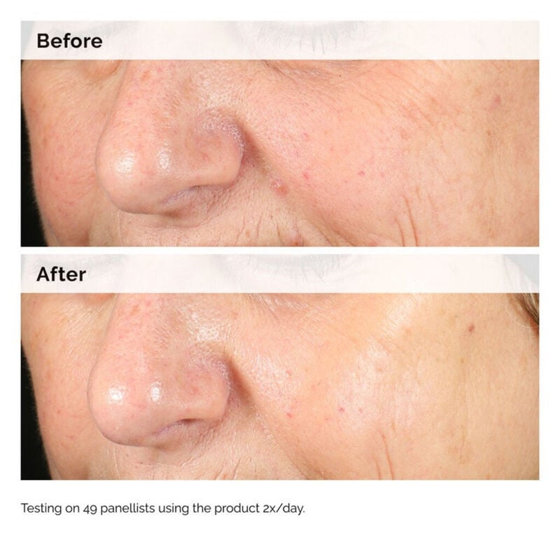 The Ordinary Alpha Arbutin 2% + HA Serum For Dark Spots 60ml