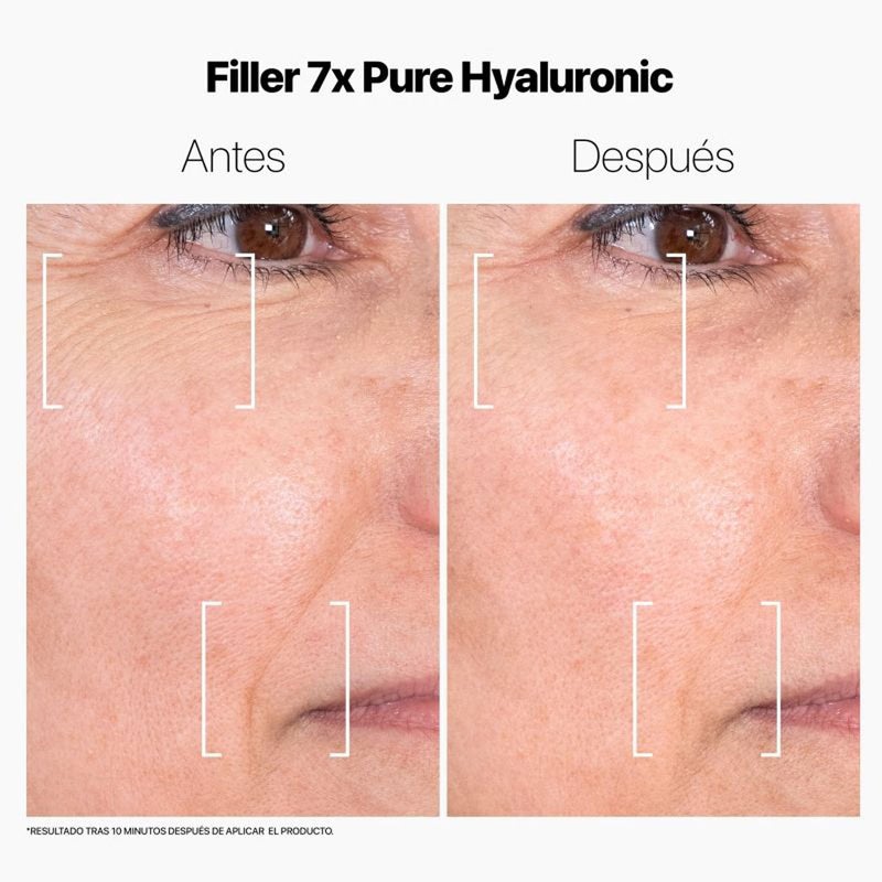 LaCabine 7x Pure Hyaluronic Acid Instant Wrinkle Filler 15ml
