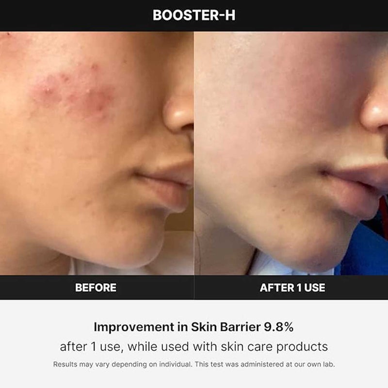 Medicube Age-R Booster H Facial Treatment Device For Deep Hydration & Glowing Skin 