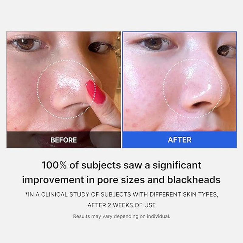 Medicube Zero Pore 2.0 AHA + BHA Facial Toner Pads For Pore Tightening 155g, Pack of 70's