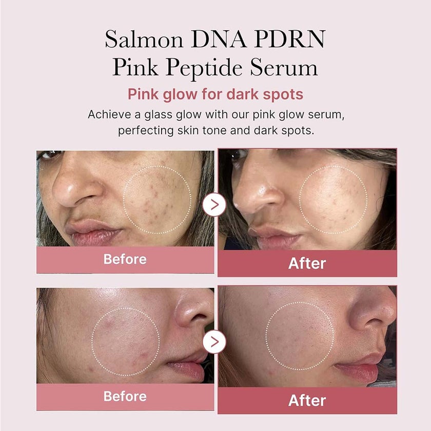 Medicube PDRN Pink Peptide Face Serum For Dark Spots 30ml