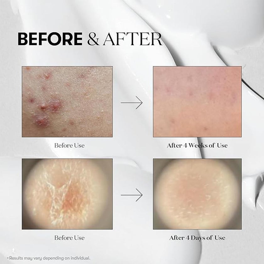 VT Cosmetics Cica Hyalon 100 Reedle Shot Face Serum 50ml