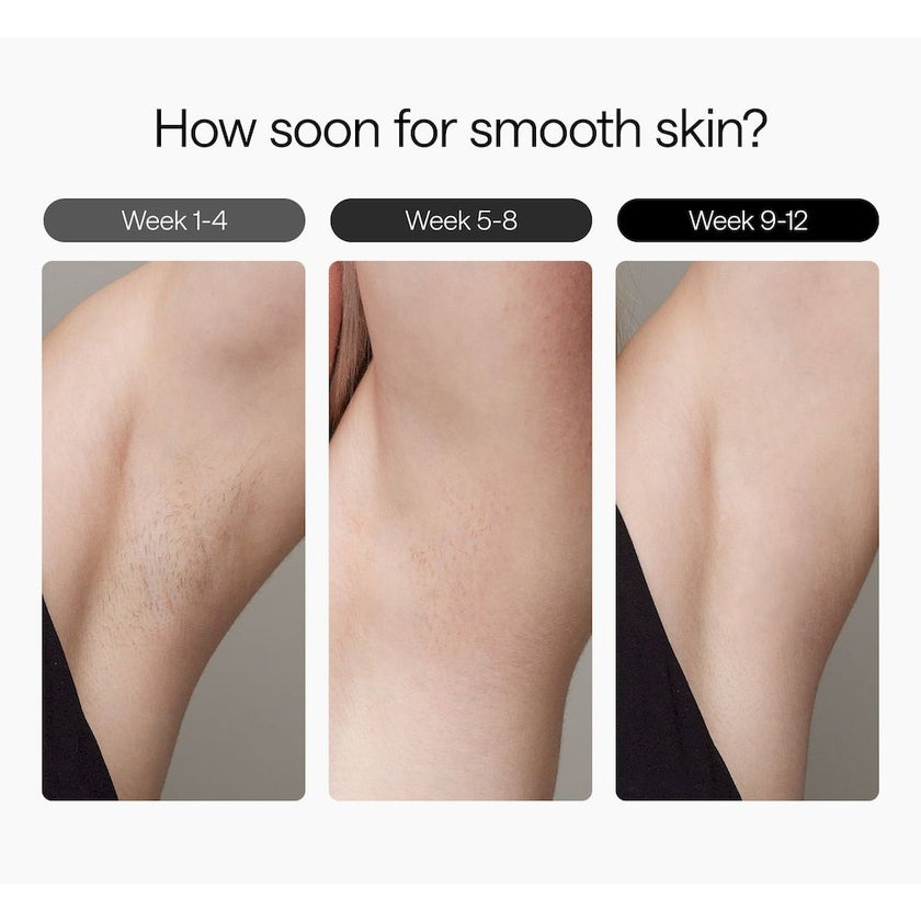 Ulike Air 3 IPL Hair Removal Device - Purple