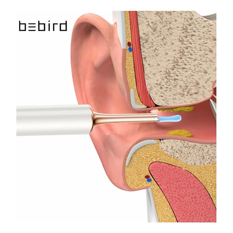 Bebird T15 Smart Visual Ear Stick Earwax Cleaner Kit