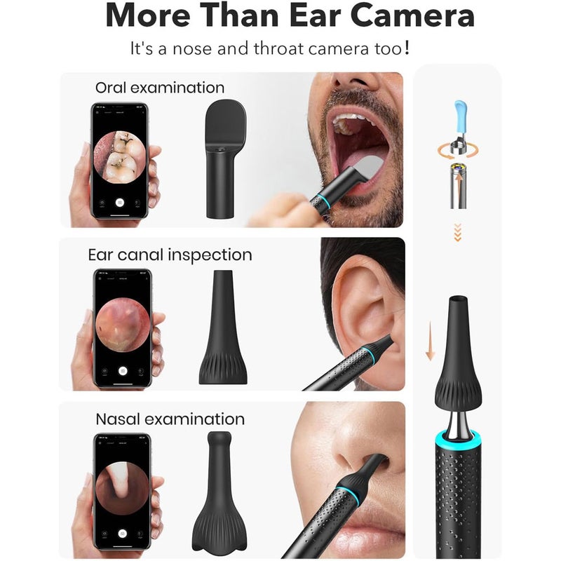 Bebird M9 S Smart Visual Ear Cleaner Kit