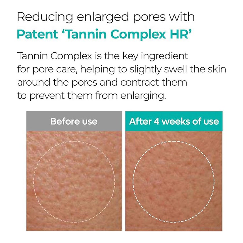 Dr. Melaxin BP Pore Clear Face Sheet Mask 25g, Pack of 5's