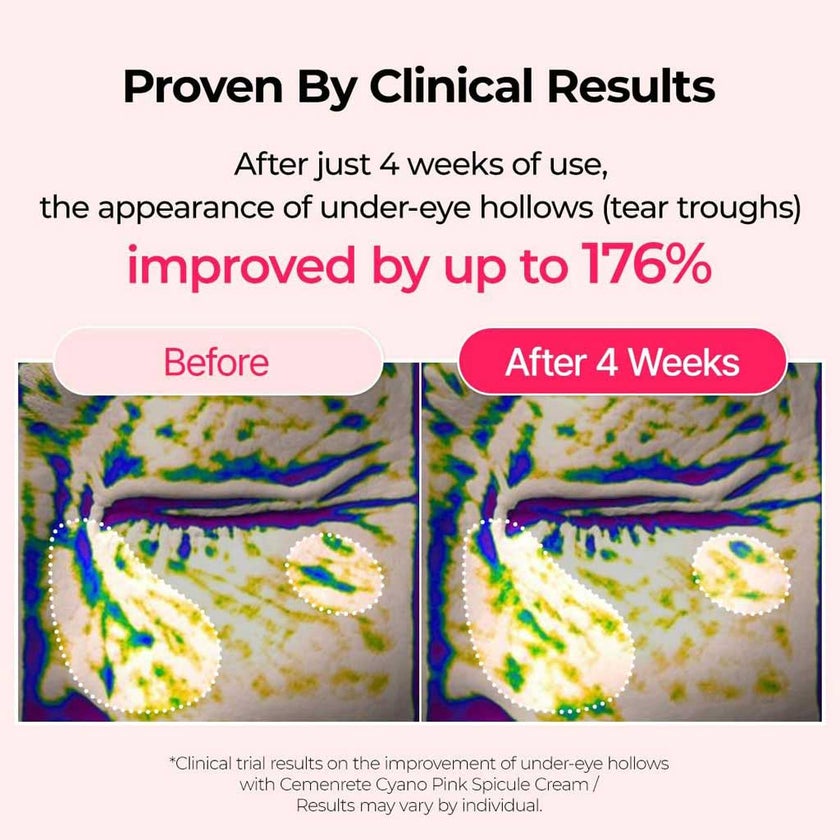 Dr. Melaxin Cemenrete Cyano Pink Spicule Cream 50ml